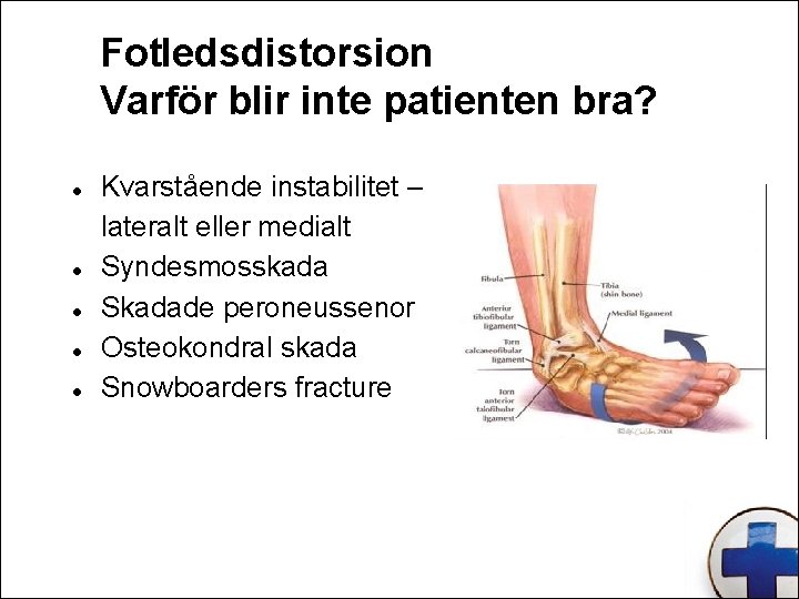 Fotledsdistorsion Varför blir inte patienten bra? Kvarstående instabilitet – lateralt eller medialt Syndesmosskada Skadade