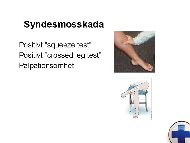 Syndesmosskada Positivt “squeeze test” Positivt “crossed leg test” Palpationsömhet 