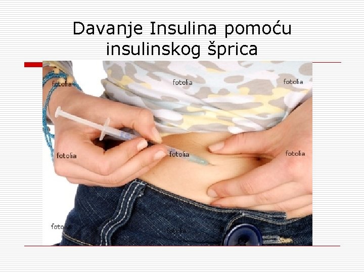 Davanje Insulina pomoću insulinskog šprica 