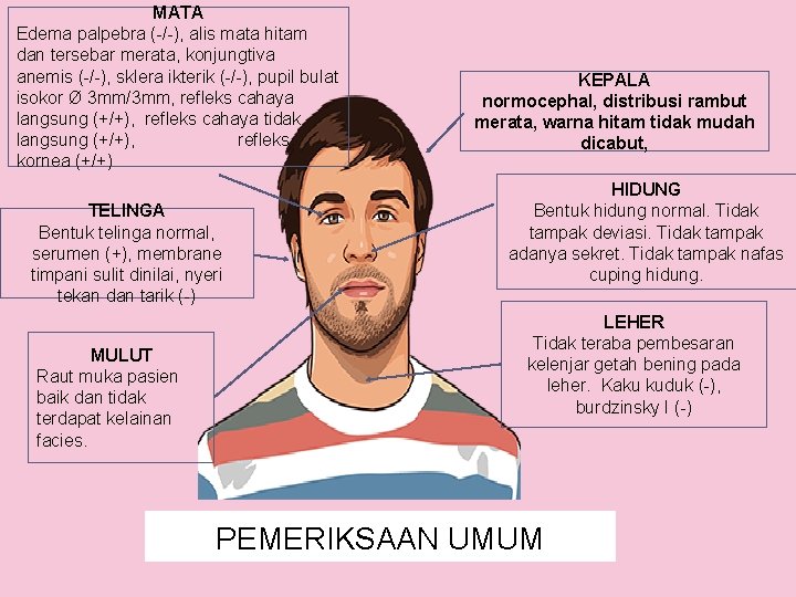 MATA Edema palpebra (-/-), alis mata hitam dan tersebar merata, konjungtiva anemis (-/-), sklera