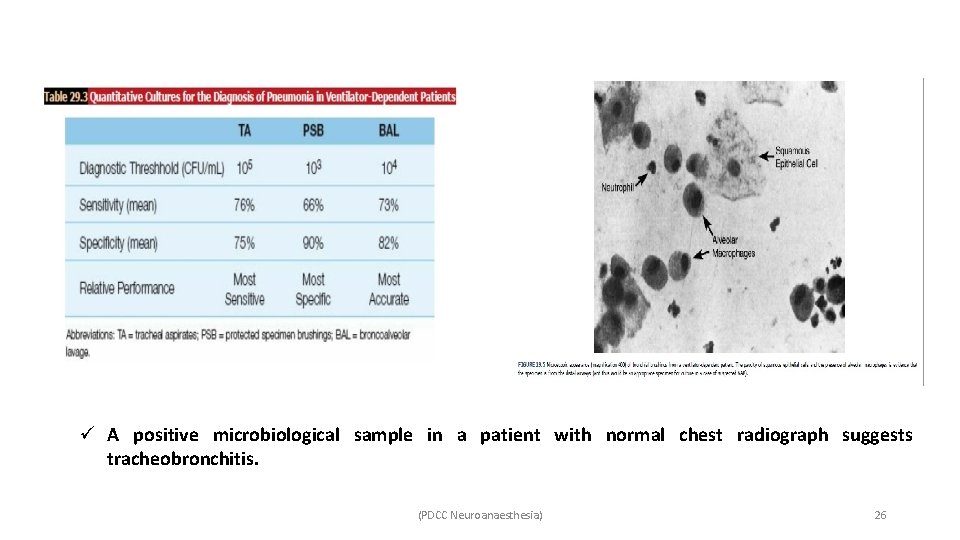 ü A positive microbiological sample in a patient with normal chest radiograph suggests tracheobronchitis.