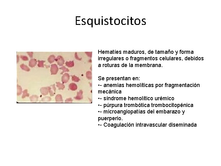 Esquistocitos Hematíes maduros, de tamaño y forma irregulares o fragmentos celulares, debidos a roturas