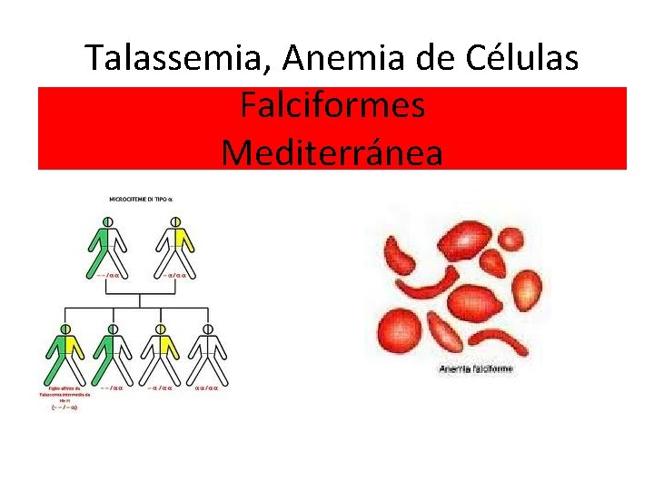 Talassemia, Anemia de Células Falciformes Mediterránea 
