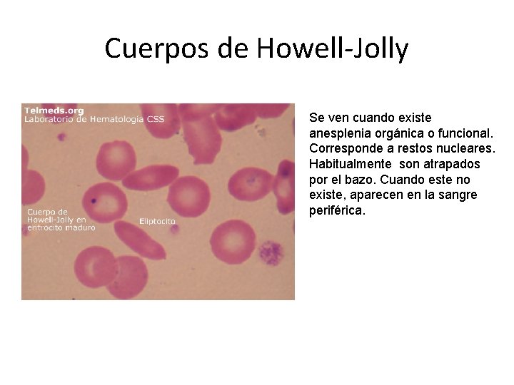 Cuerpos de Howell-Jolly Se ven cuando existe anesplenia orgánica o funcional. Corresponde a restos