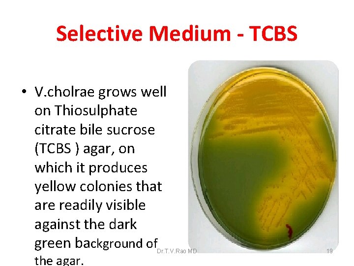 Selective Medium - TCBS • V. cholrae grows well on Thiosulphate citrate bile sucrose