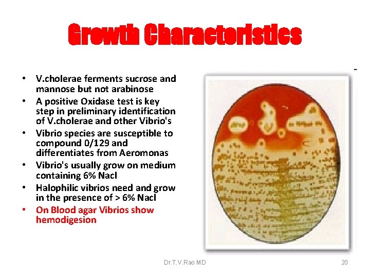 Growth Characteristics • V. cholerae ferments sucrose and mannose but not arabinose • A