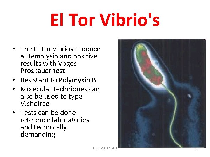 El Tor Vibrio's • The El Tor vibrios produce a Hemolysin and positive results