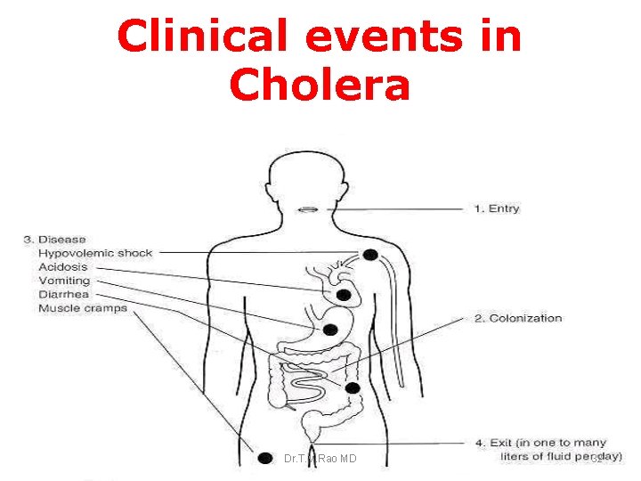 Clinical events in Cholera Dr. T. V. Rao MD 32 