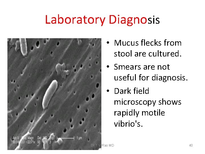 Laboratory Diagnosis • Mucus flecks from stool are cultured. • Smears are not useful