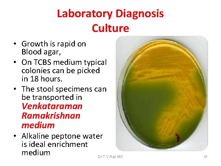 Laboratory Diagnosis Culture • Growth is rapid on Blood agar, • On TCBS medium