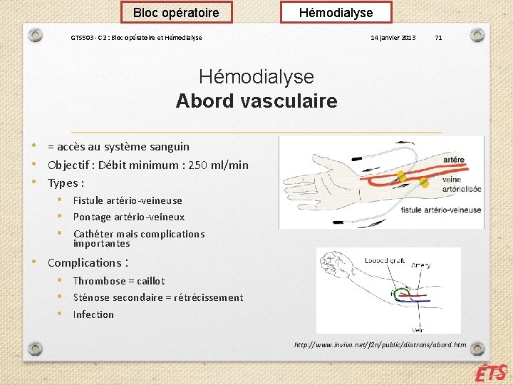 Bloc opératoire Hémodialyse GTS 503 - C 2 : Bloc opératoire et Hémodialyse 14
