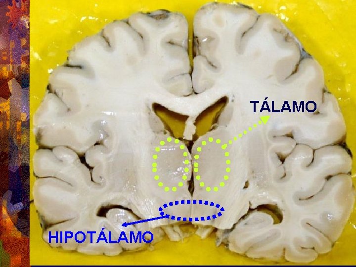 TÁLAMO HIPOTÁLAMO 