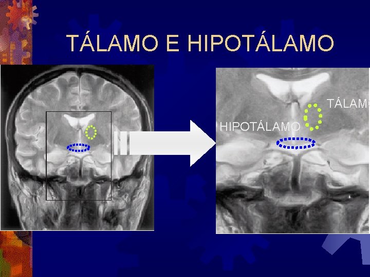 TÁLAMO E HIPOTÁLAMO 