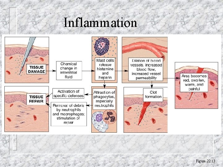 Inflammation Figure 22. 13 