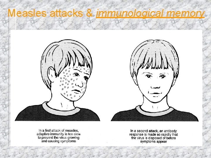 Measles attacks & immunological memory 