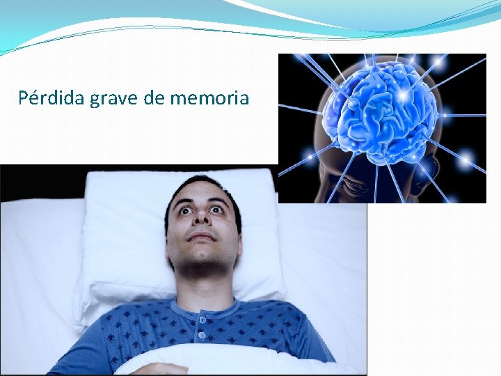 Pérdida grave de memoria 