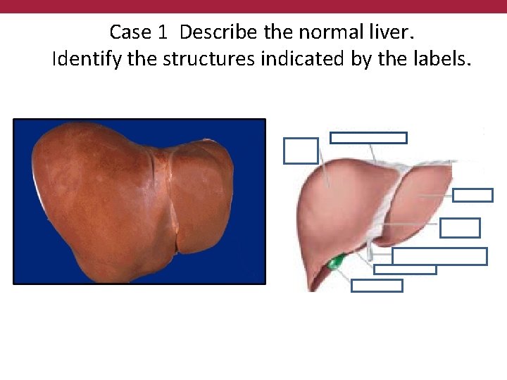 Case 1 Describe the normal liver. Identify the structures indicated by the labels. 