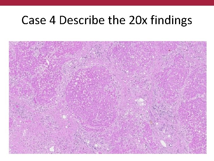 Case 4 Describe the 20 x findings 