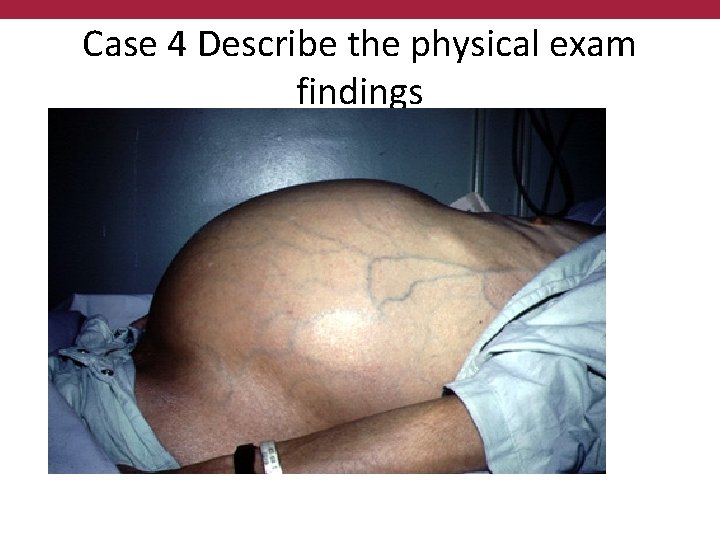Case 4 Describe the physical exam findings 