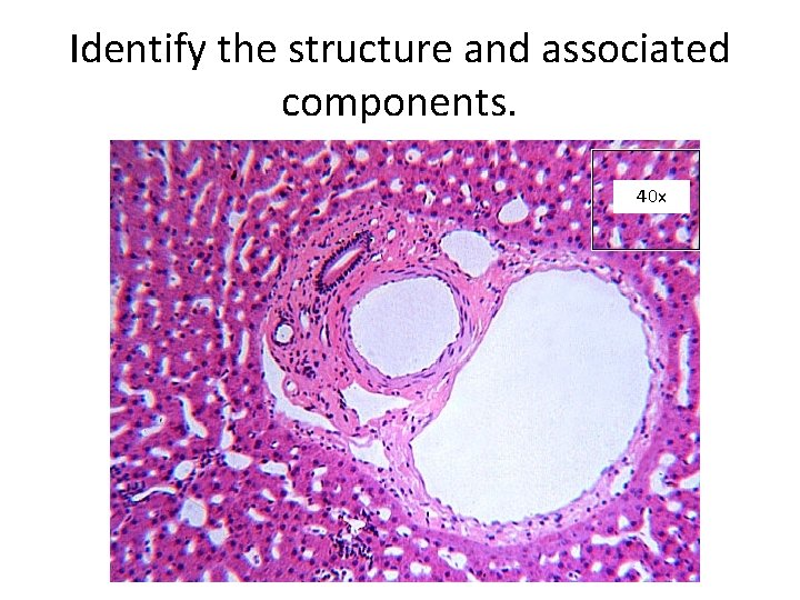 Identify the structure and associated components. 40 x 