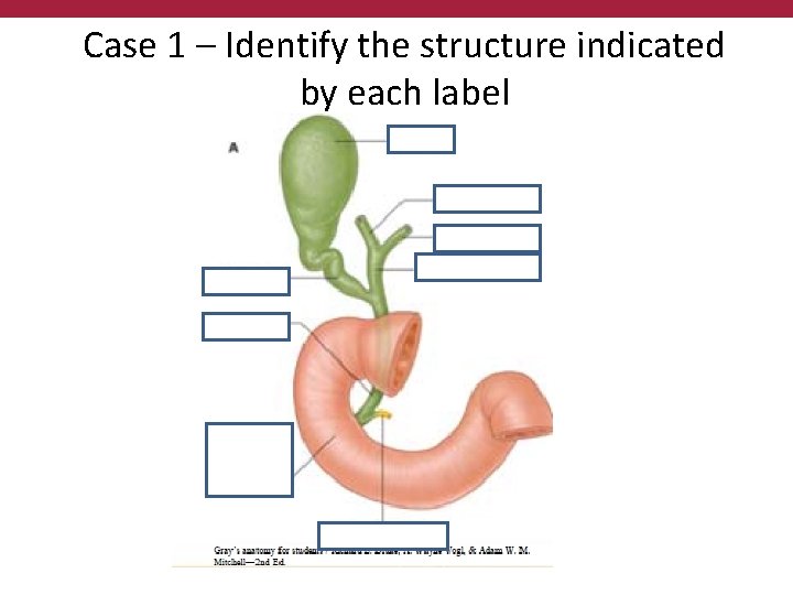 Case 1 – Identify the structure indicated by each label 