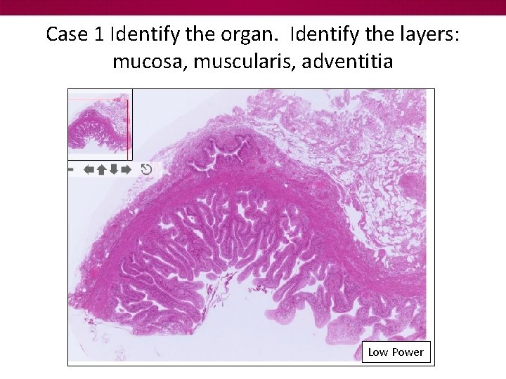 Case 1 Identify the organ. Identify the layers: mucosa, muscularis, adventitia Low Power 