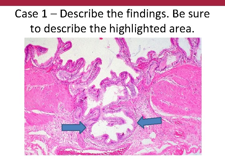 Case 1 – Describe the findings. Be sure to describe the highlighted area. 