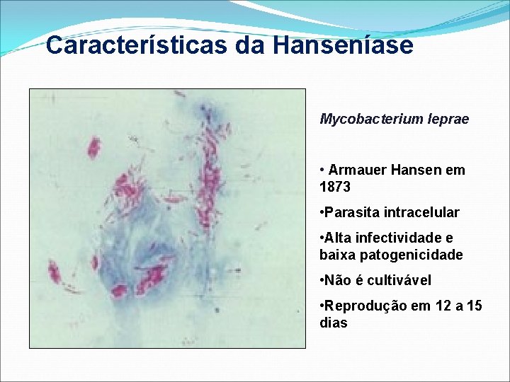 Características da Hanseníase Mycobacterium leprae • Armauer Hansen em 1873 • Parasita intracelular •