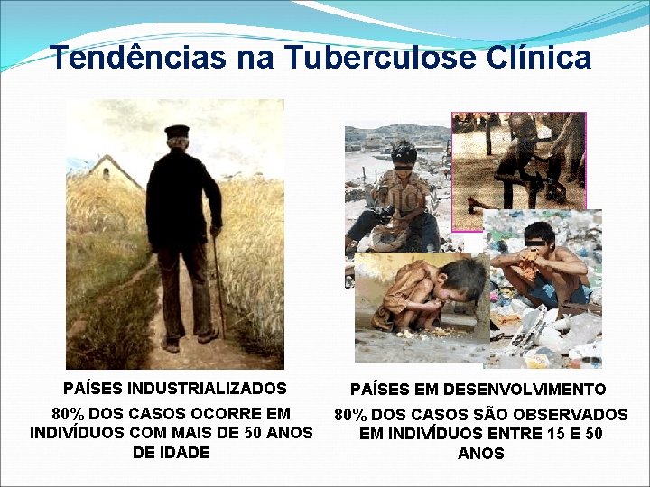 Tendências na Tuberculose Clínica PAÍSES INDUSTRIALIZADOS PAÍSES EM DESENVOLVIMENTO 80% DOS CASOS OCORRE EM