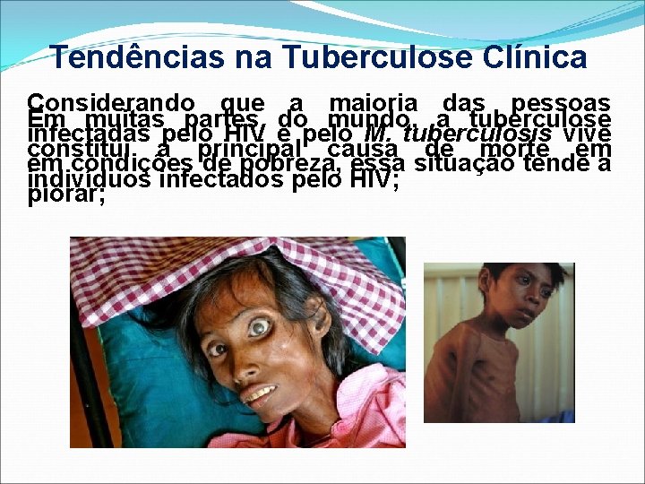 Tendências na Tuberculose Clínica Considerando que a maioria das pessoas Em muitas partes do