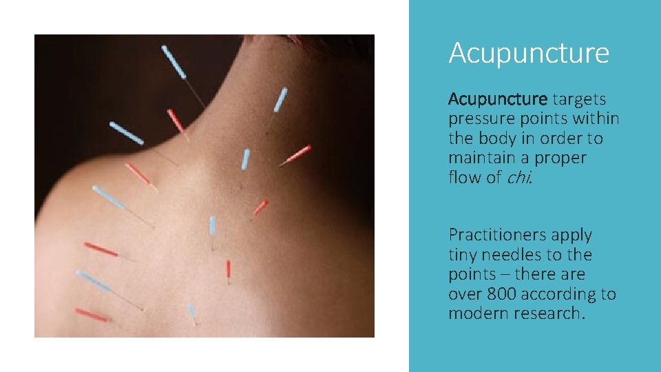 Acupuncture targets pressure points within the body in order to maintain a proper flow