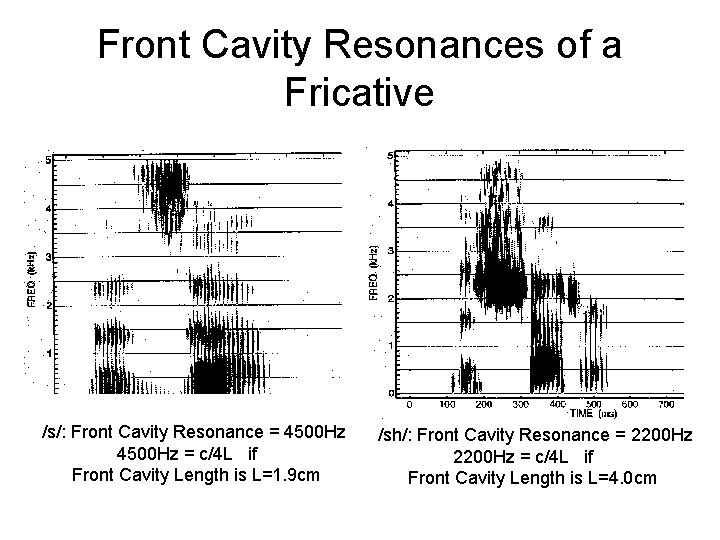 Front Cavity Resonances of a Fricative /s/: Front Cavity Resonance = 4500 Hz =