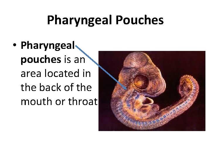 Pharyngeal Pouches • Pharyngeal pouches is an area located in the back of the