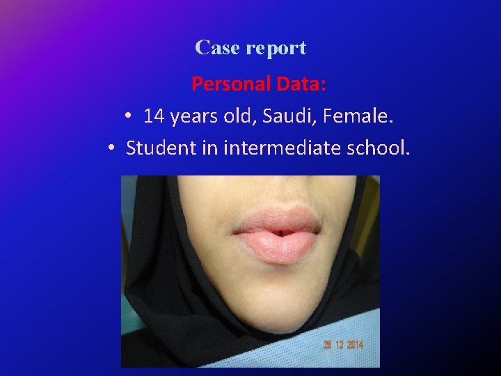 Case report Personal Data: • 14 years old, Saudi, Female. • Student in intermediate