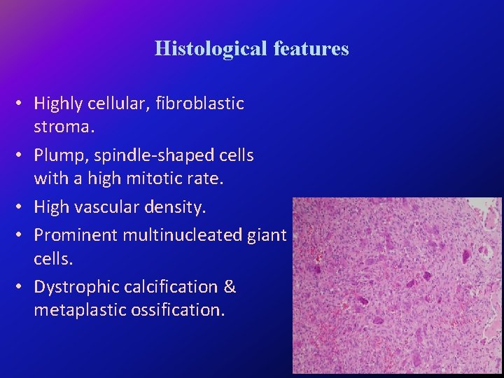 Histological features • Highly cellular, fibroblastic stroma. • Plump, spindle-shaped cells with a high