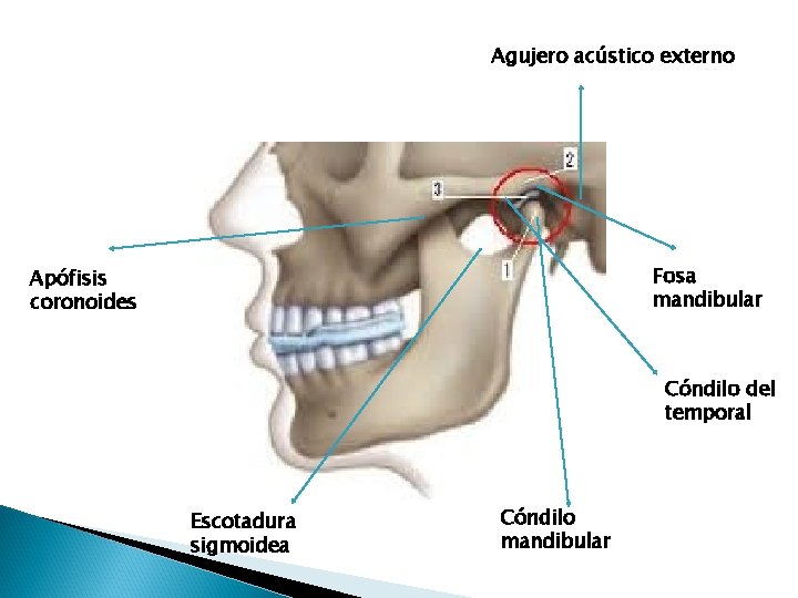 Agujero acústico externo Fosa mandibular Apófisis coronoides Cóndilo del temporal Escotadura sigmoidea Cóndilo mandibular