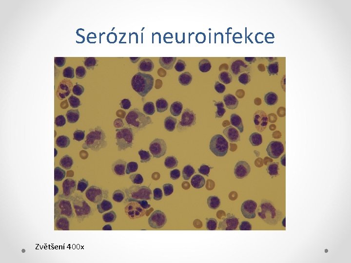 Serózní neuroinfekce Zvětšení 400 x 