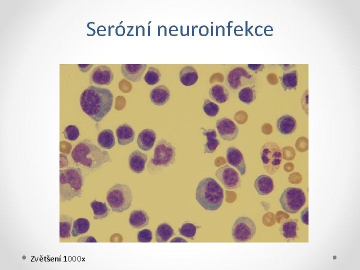 Serózní neuroinfekce Zvětšení 1000 x 