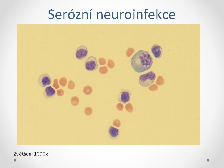 Serózní neuroinfekce Zvětšení 1000 x 