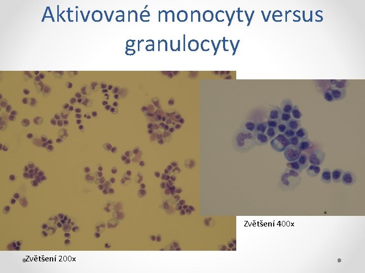 Aktivované monocyty versus granulocyty Zvětšení 400 x Zvětšení 200 x 