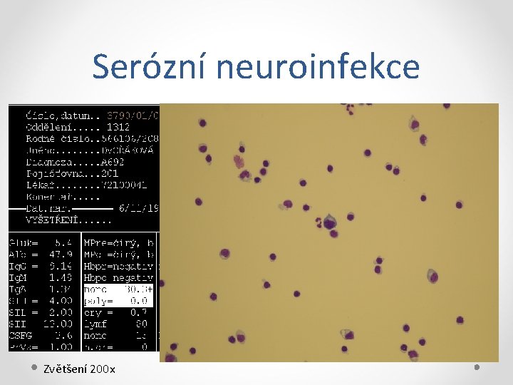 Serózní neuroinfekce Zvětšení 200 x 
