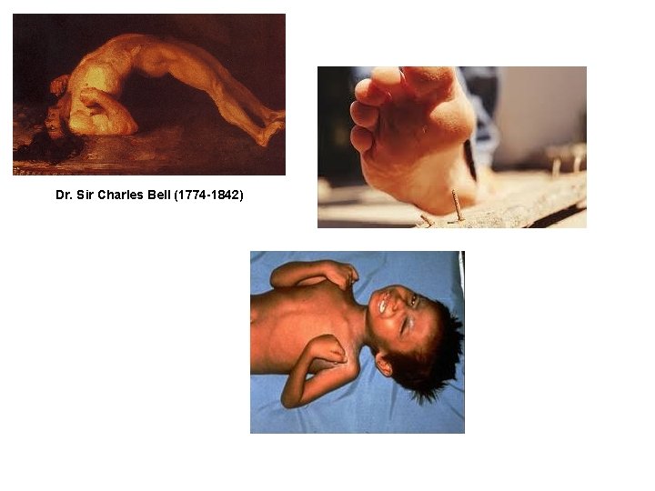 Dr. Sir Charles Bell (1774 -1842) 