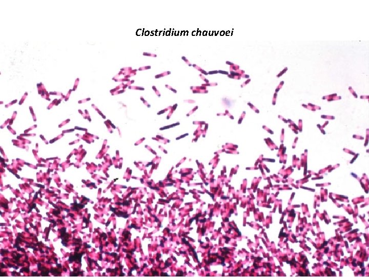 Clostridium chauvoei 