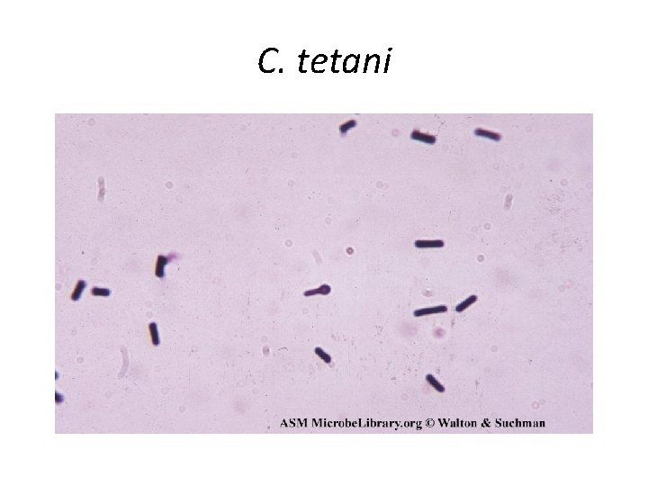 C. tetani 