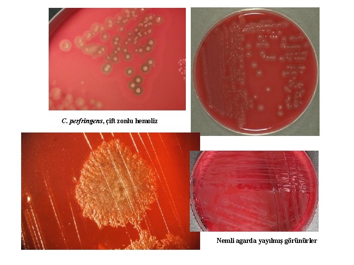 C. perfringens, çift zonlu hemoliz Nemli agarda yayılmış görünürler 