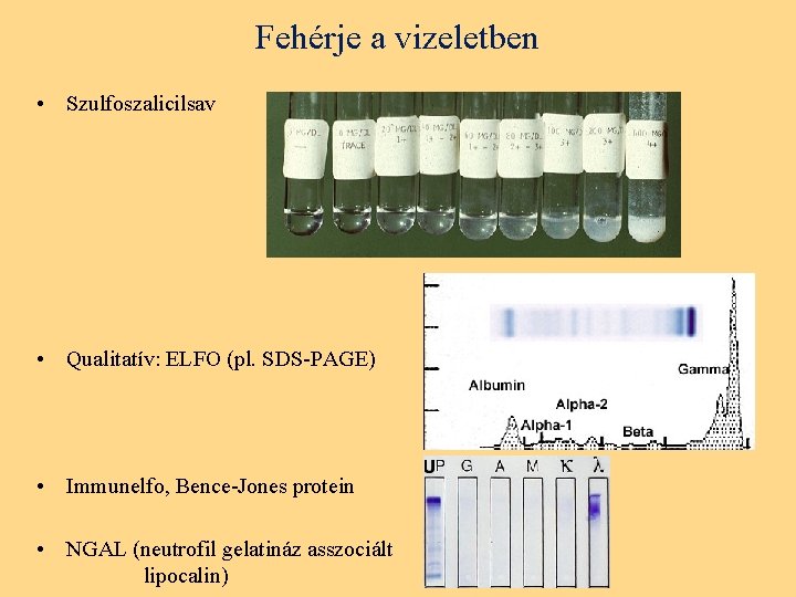 Fehérje a vizeletben • Szulfoszalicilsav • Qualitatív: ELFO (pl. SDS-PAGE) • Immunelfo, Bence-Jones protein