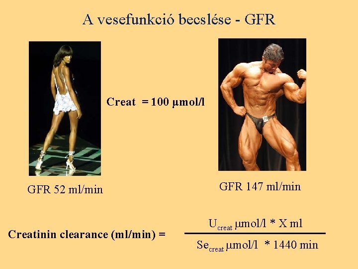 A vesefunkció becslése - GFR Creat = 100 μmol/l GFR 52 ml/min Creatinin clearance
