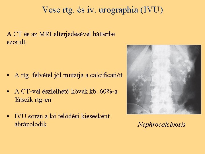 Vese rtg. és iv. urographia (IVU) A CT és az MRI elterjedésével háttérbe szorult.