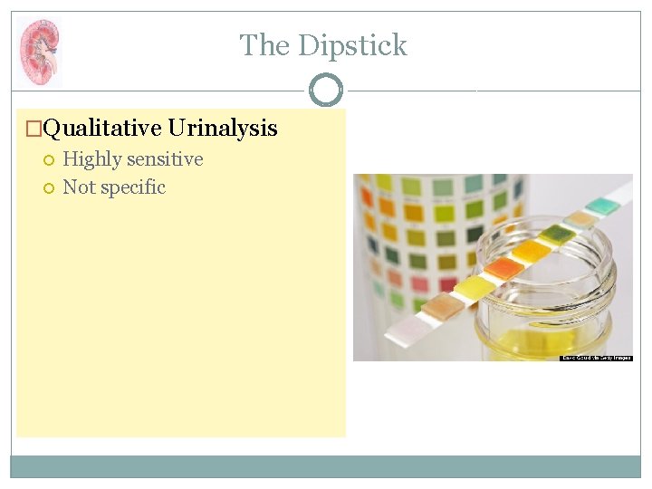 The Dipstick �Qualitative Urinalysis Highly sensitive Not specific 