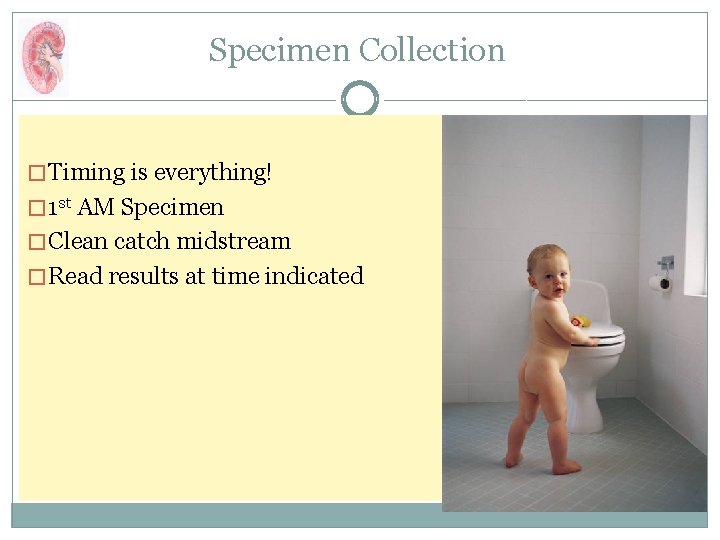 Specimen Collection � Timing is everything! � 1 st AM Specimen � Clean catch
